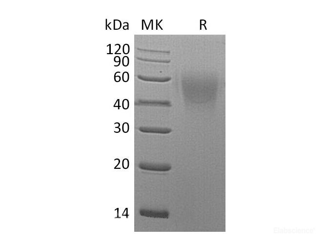 Recombinant Mouse B7-2 / CD86 Protein (C-His)-Elabscience
