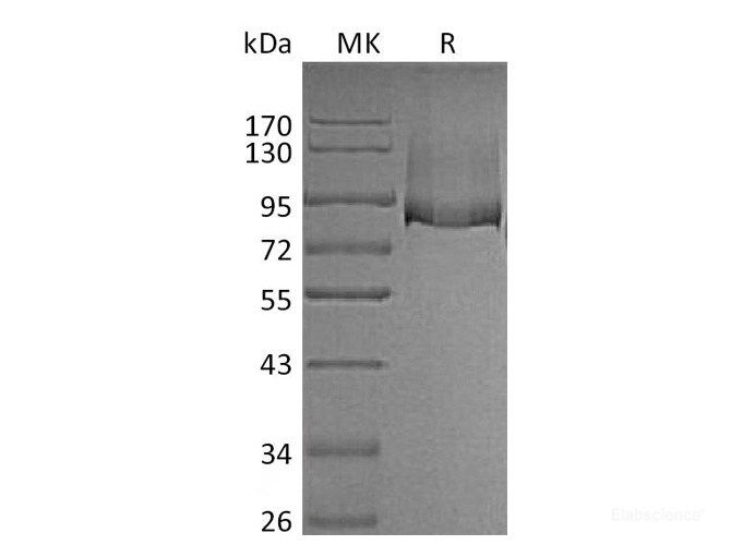 Recombinant Mouse Thrombomodulin Protein (C-His)-Elabscience