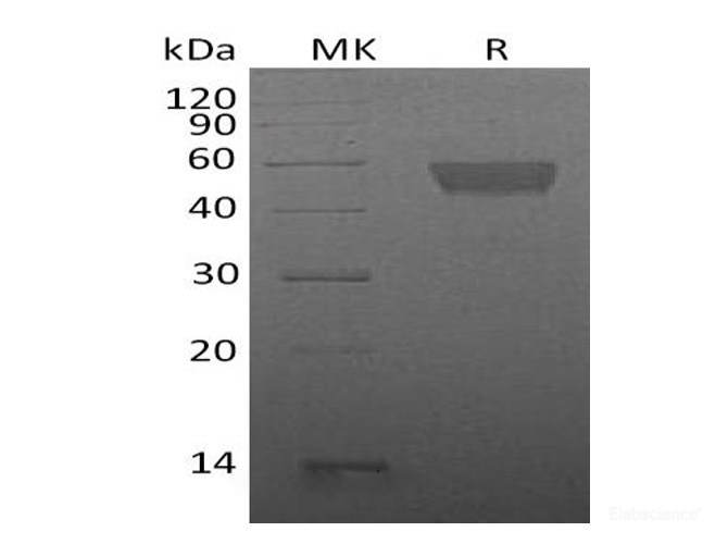 Recombinant Mouse TIGIT / VSIG9 / VSTM3 Protein (C-Fc)-Elabscience