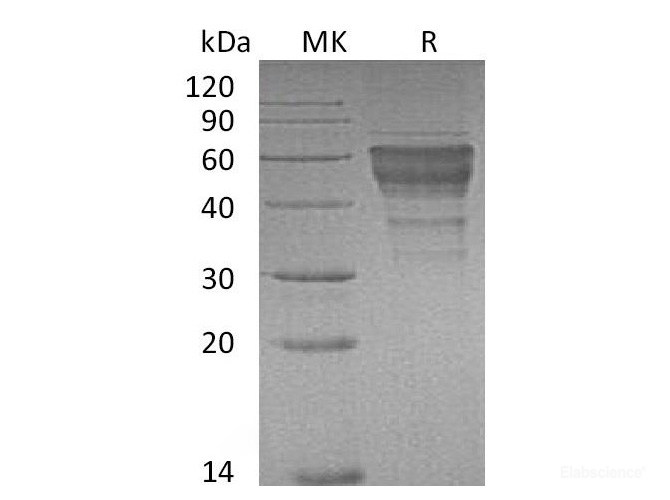 Recombinant Mouse TIM-3 / HAVCR2 Protein (C-Fc)-Elabscience