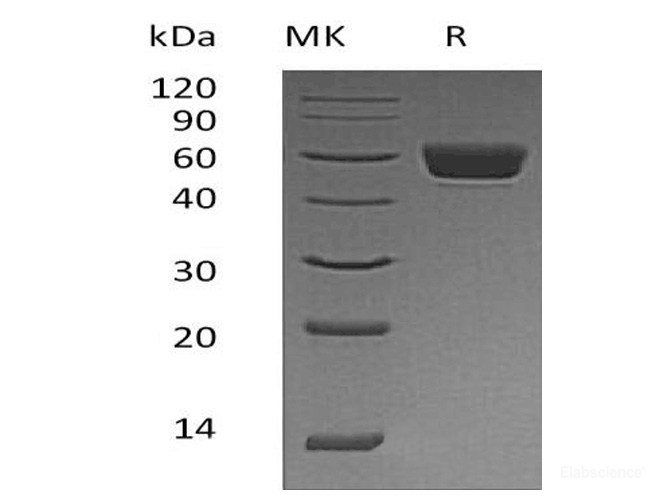 Recombinant Mouse Serpin A3N Protein (C-His)-Elabscience