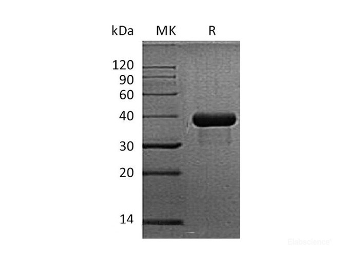 Recombinant Mouse SPARC Protein (C-His)-Elabscience
