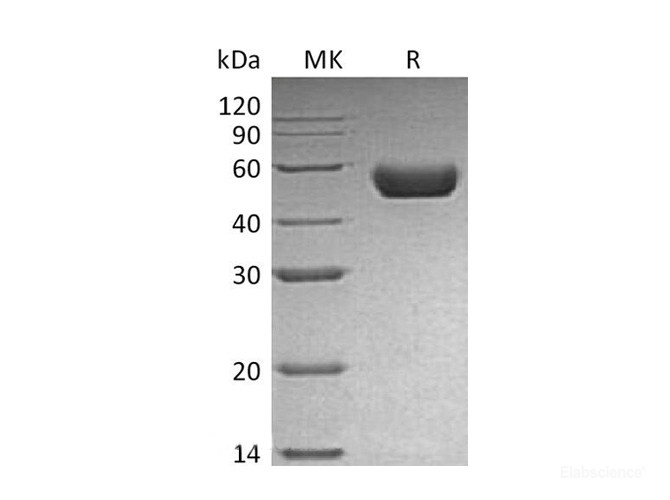 Recombinant Mouse Renin Protein (C-His)-Elabscience