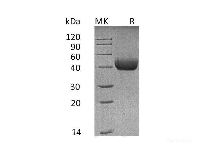 Recombinant Mouse SP-D Protein (C-His)-Elabscience
