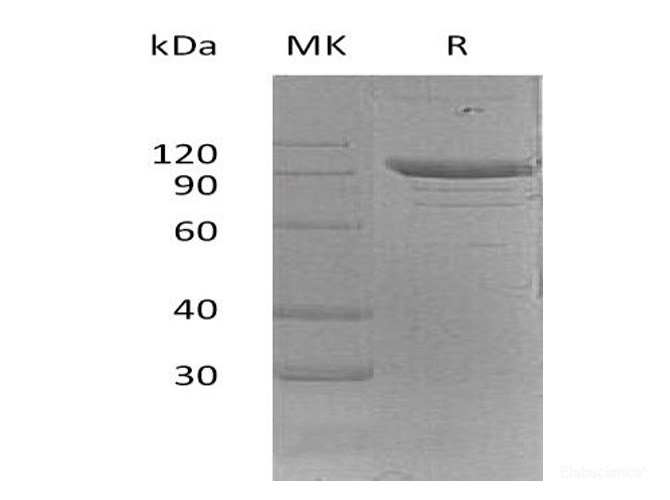 Recombinant Mouse PSGL-1 / CD162 / SELPLG Protein (C-Fc)-Elabscience