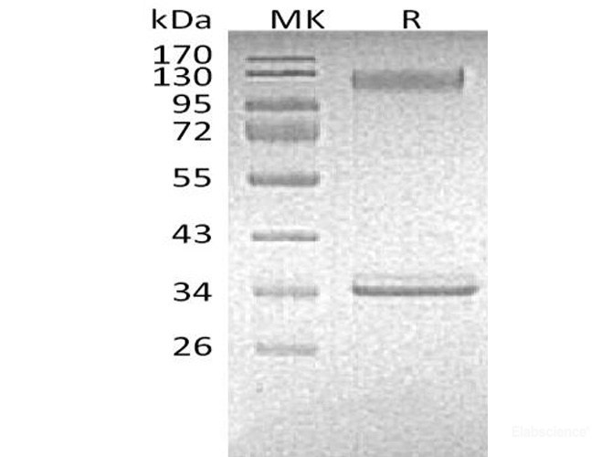 Recombinant Mouse P-selectin / CD62P Protein (C-Fc)-Elabscience