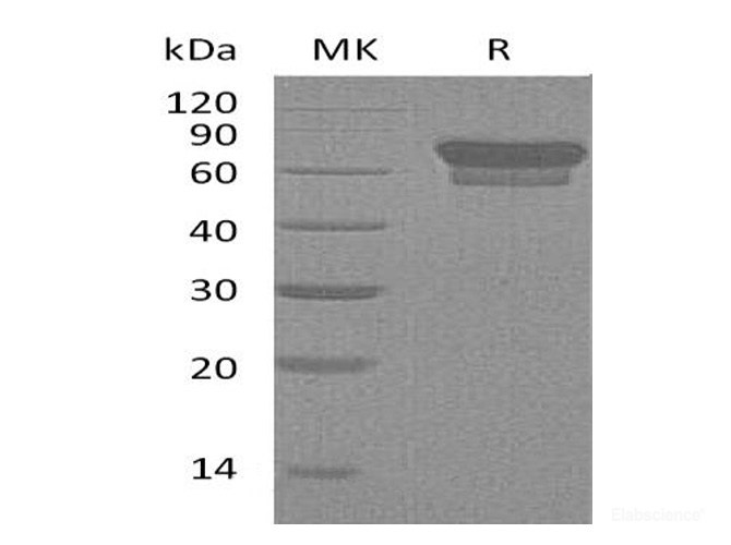 Recombinant Mouse PD-1 / CD279 / PDCD1 Protein (C-Fc)-Elabscience