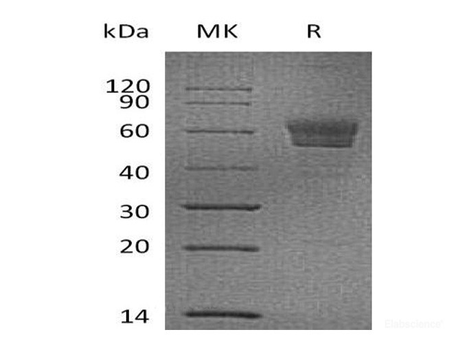 Recombinant Mouse Podoplanin Protein (C-Fc)-Elabscience