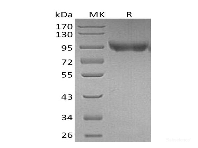 Recombinant Mouse CD31 / PECAM-1 Protein (C-His)-Elabscience