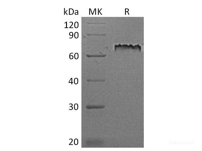 Recombinant Mouse Notch 1 / Motch A Protein (C-His)-Elabscience