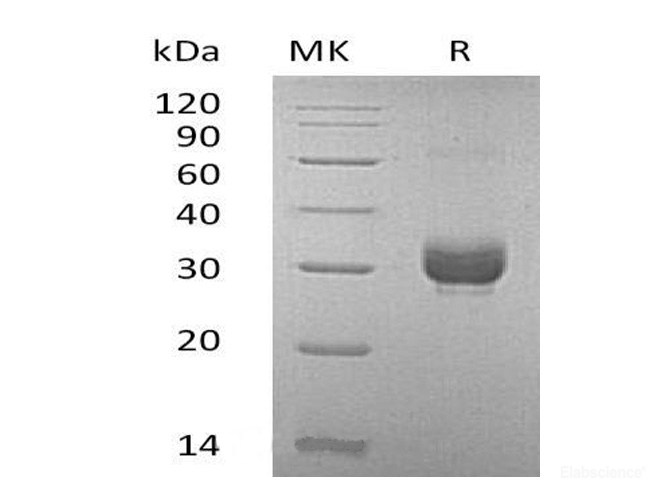 Recombinant Mouse Noggin / NOG Protein (C-His)