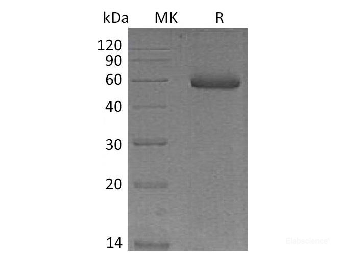 Recombinant Mouse NGAL / Lipocalin-2 Protein (C-Fc)-Elabscience