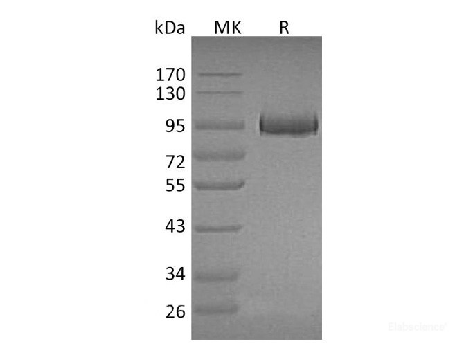 Recombinant Mouse Myeloperoxidase / MPO Protein (C-His)-Elabscience