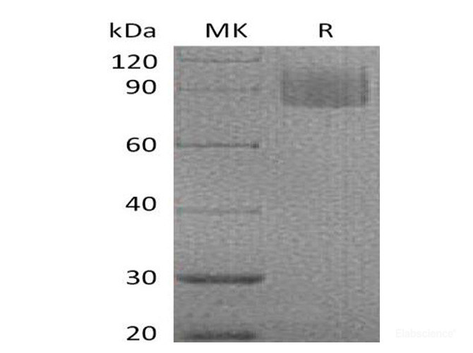 Recombinant Mouse MAG / Siglec-4a Protein (C-His)-Elabscience