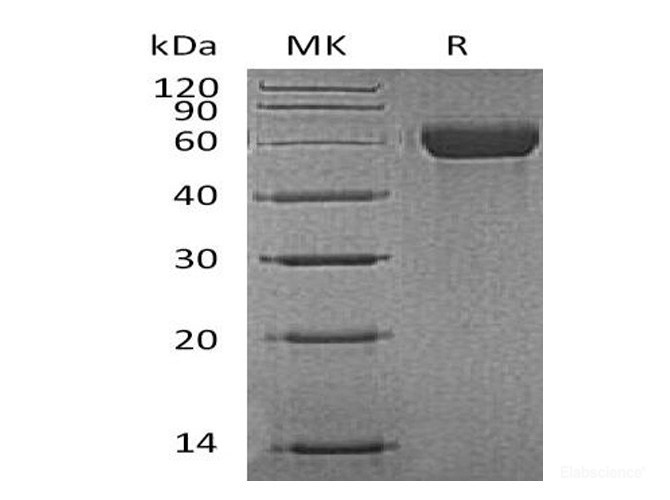 Recombinant Mouse MARCO Protein (N-His)-Elabscience