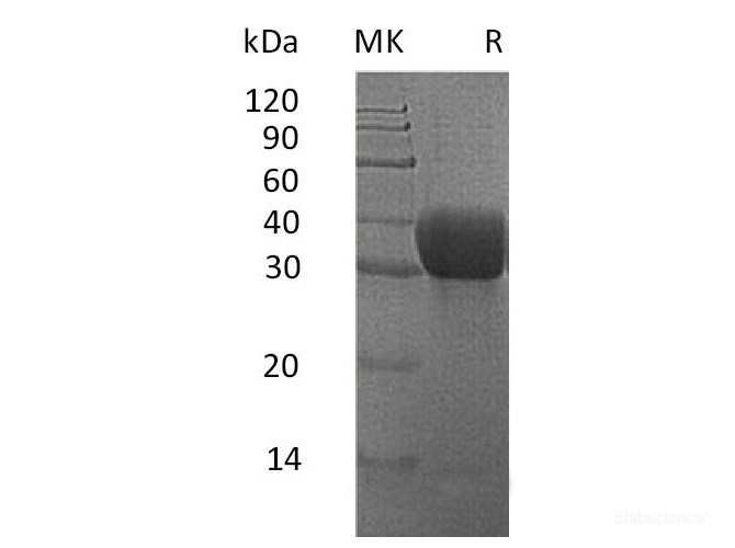 Recombinant Mouse MGL2 / CD301b Protein (N-His)-Elabscience
