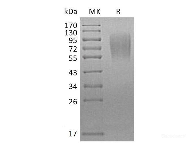 Recombinant Mouse LAMP1 / CD107a Protein (C-His)-Elabscience