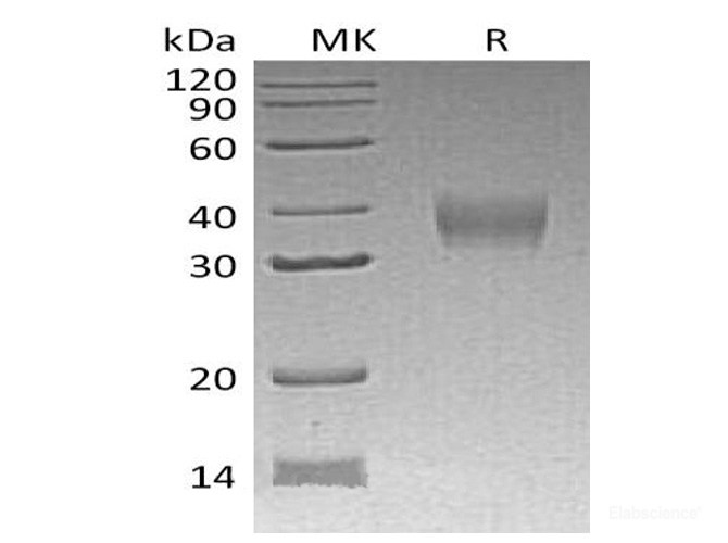 Recombinant Mouse LILRB4 / CD85k / ILT3 Protein (C-His)-Elabscience