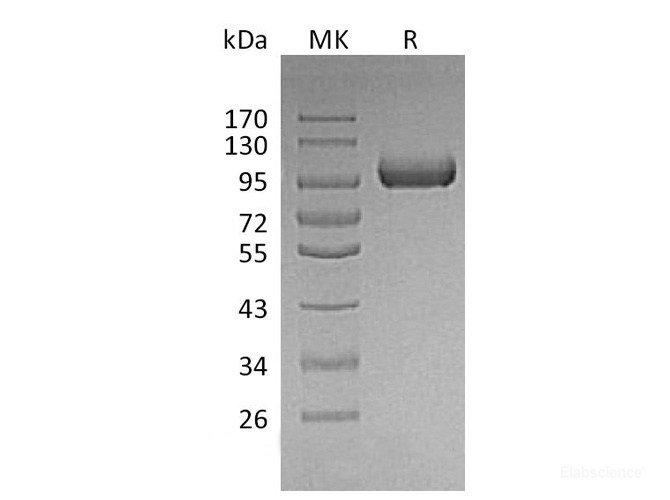 Recombinant Mouse LRIG1 Protein (C-His)-Elabscience