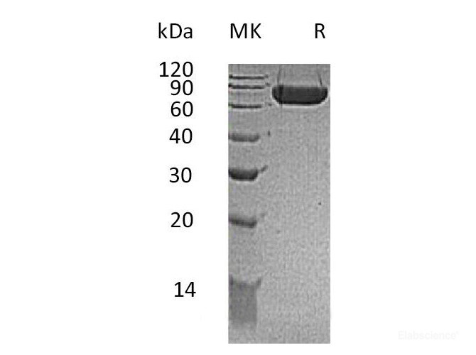 Recombinant Mouse KIRREL1 / NEPH1 Protein (C-His)-Elabscience