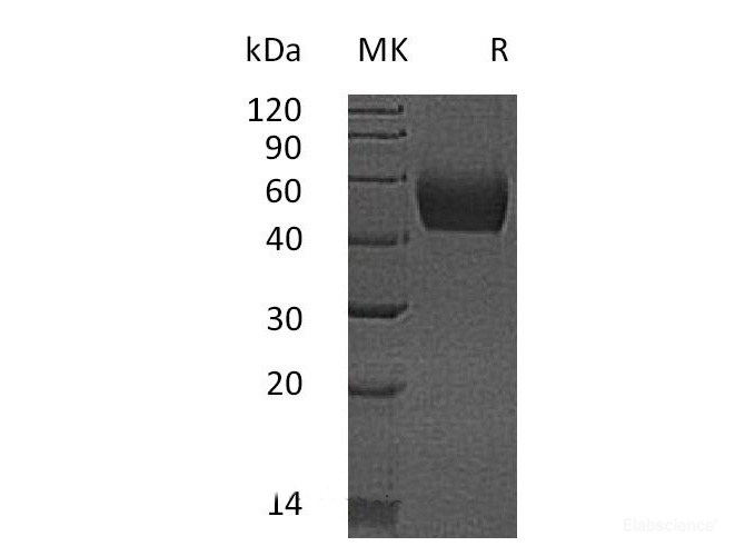 Recombinant Mouse Lumican / LUM  Protein (C-His)-Elabscience