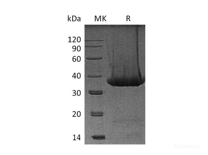 Recombinant Mouse Kallikrein 1 / mGK-6 Protein (C-His)-Elabscience