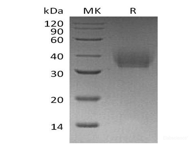 Recombinant Mouse Interleukin-21 Receptor / IL-21R Protein (C-His)-Elabscience