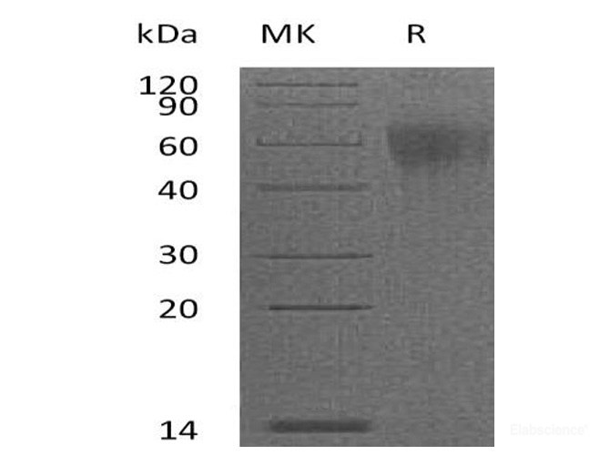 Recombinant Mouse IL-2 R gamma / IL-2RG / CD132 Protein (C-His)-Elabscience