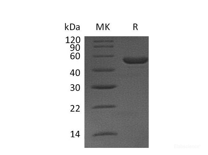 Recombinant Mouse IL-11 / Interleukin-11 Protein (C-Fc)-Elabscience