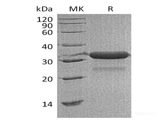 Recombinant Mouse IGFBP-7 / IGFBP7 Protein (C-His)-Elabscience