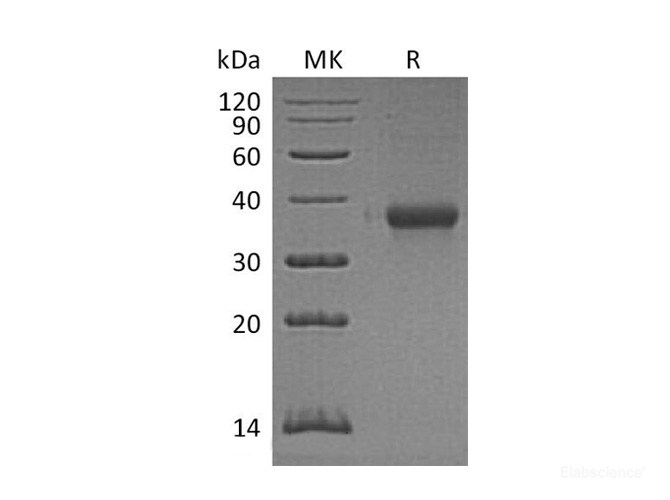 Recombinant Mouse IMPAD1 / IMP3 Protein (N-His)-Elabscience