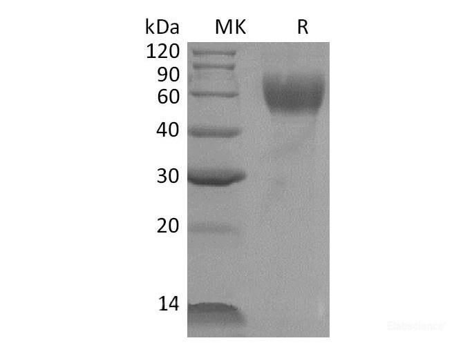Recombinant Mouse IL1R1 / CD121a Protein (C-His)-Elabscience