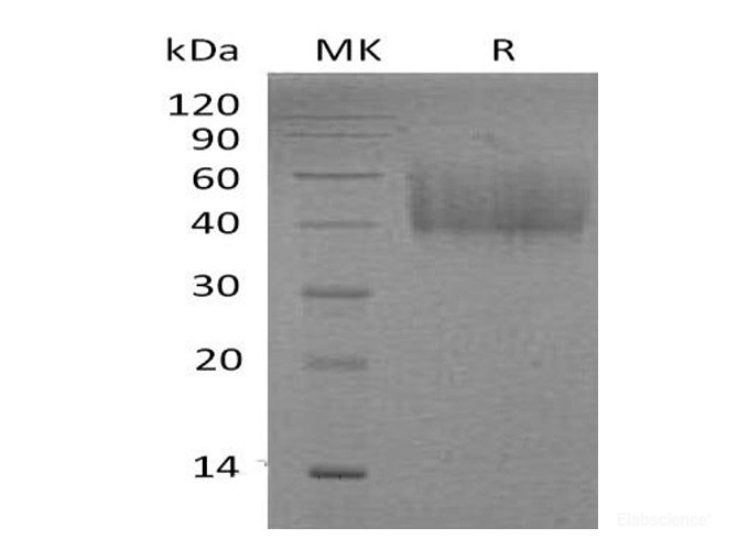 Recombinant Mouse B7-H2 / CD275 Protein (C-His)-Elabscience