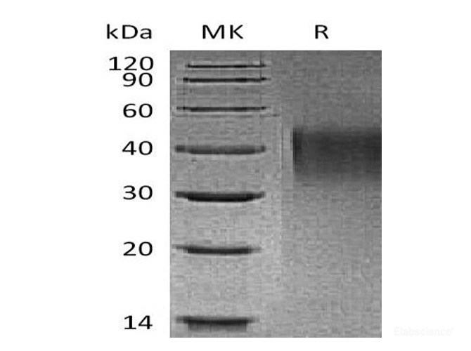 Recombinant Mouse TIM-1 / HAVCR1 Protein (C-His)-Elabscience