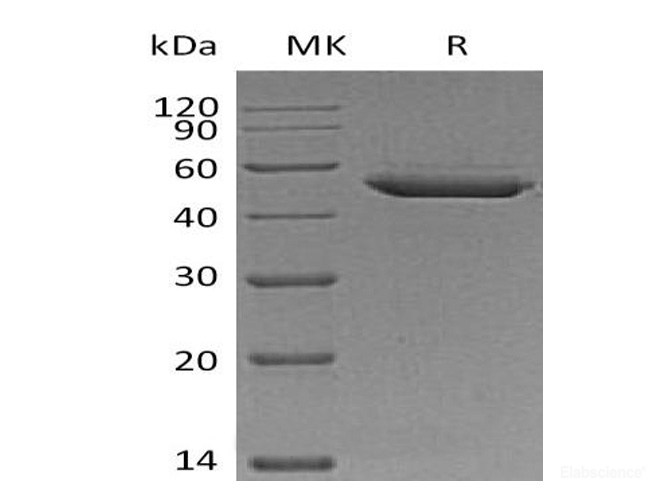 Recombinant Mouse Serpin E2 / PN1 Protein (C-His)-Elabscience