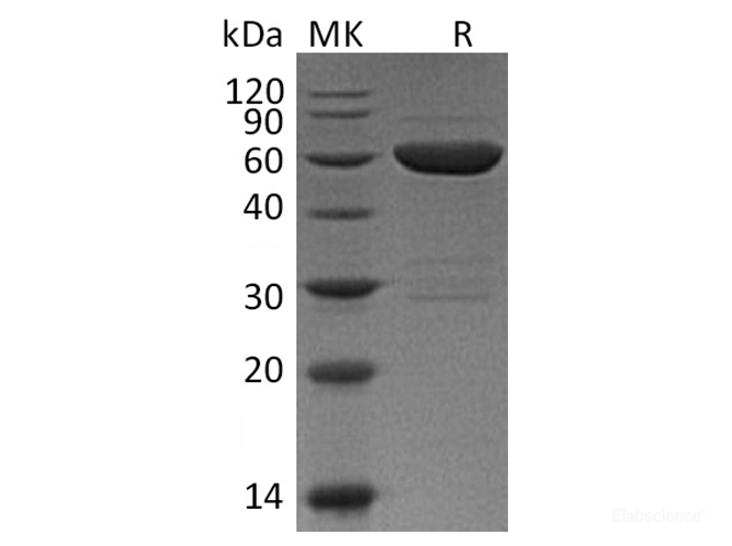 Recombinant Mouse Galectin-9 / LGALS9 Protein (N-GST)-Elabscience