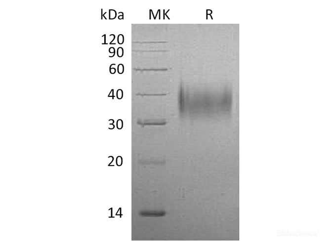 Recombinant Mouse CD16 / FCGR3 Protein (C-His)-Elabscience