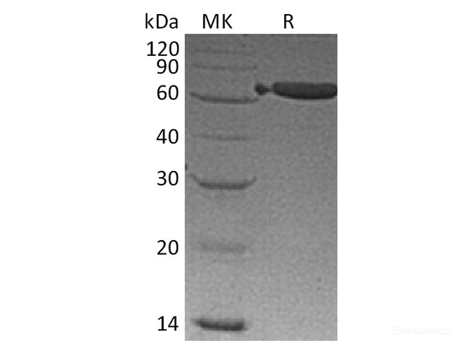 Recombinant Mouse EpCAM / TROP-1 / CD326 /  Protein (C-Fc)-Elabscience