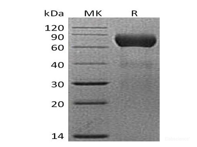 Recombinant Mouse ENTPD2 / CD39L1 Protein (C-His)-Elabscience
