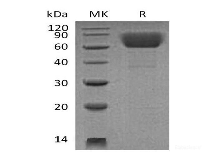 Recombinant Mouse CD39 / ENTPD1 Protein (C-His)-Elabscience