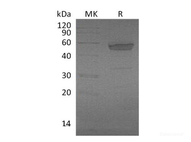 Recombinant Mouse EDA2R / TNFRSF27 Protein (C-Fc)-Elabscience