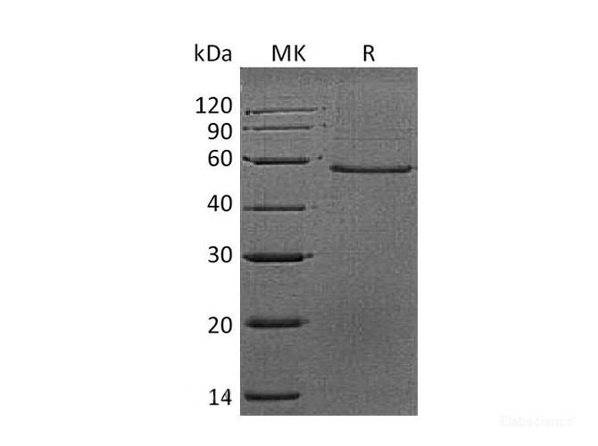 Recombinant Mouse Dermatopontin / DPT Protein (C-Fc)-Elabscience