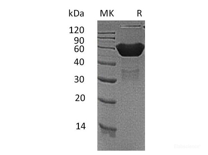 Recombinant Mouse CXADR / CAR Protein (C-Fc)-Elabscience