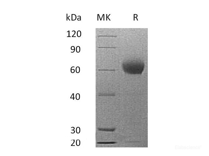 Recombinant Mouse Complement Factor H / CFH Protein (C-His)-Elabscience