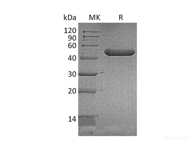 Recombinant Mouse YM1 / ECF-L / CHI3L3 Protein (C-His)-Elabscience