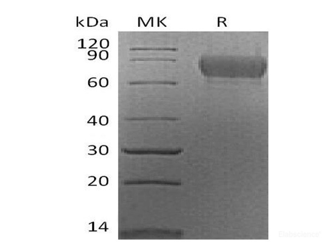 Recombinant Mouse CADM1 / IGSF4A Protein (C-His)-Elabscience