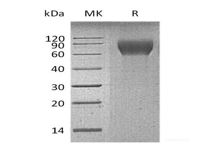Recombinant Mouse CD6 / TP120 Protein (C-His)-Elabscience