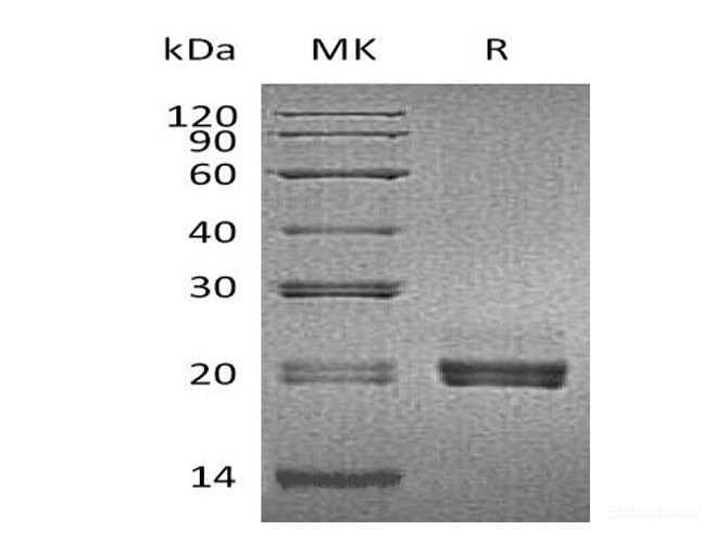 Recombinant Mouse CD40L / CD154 / TNFSF5 Protein (N-His)-Elabscience