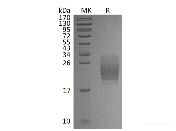 Recombinant Mouse CD160 / BY55 Protein (C-His)-Elabscience