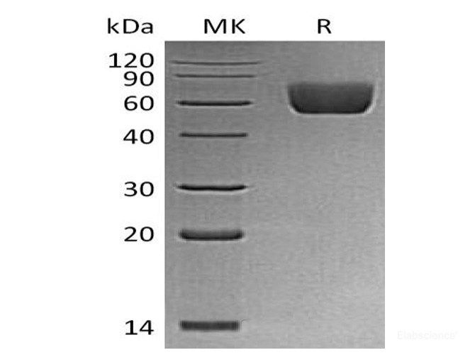 Recombinant Mouse BTNL2 / Butyrophilin-like Protein 2 Protein (C-His)-Elabscience